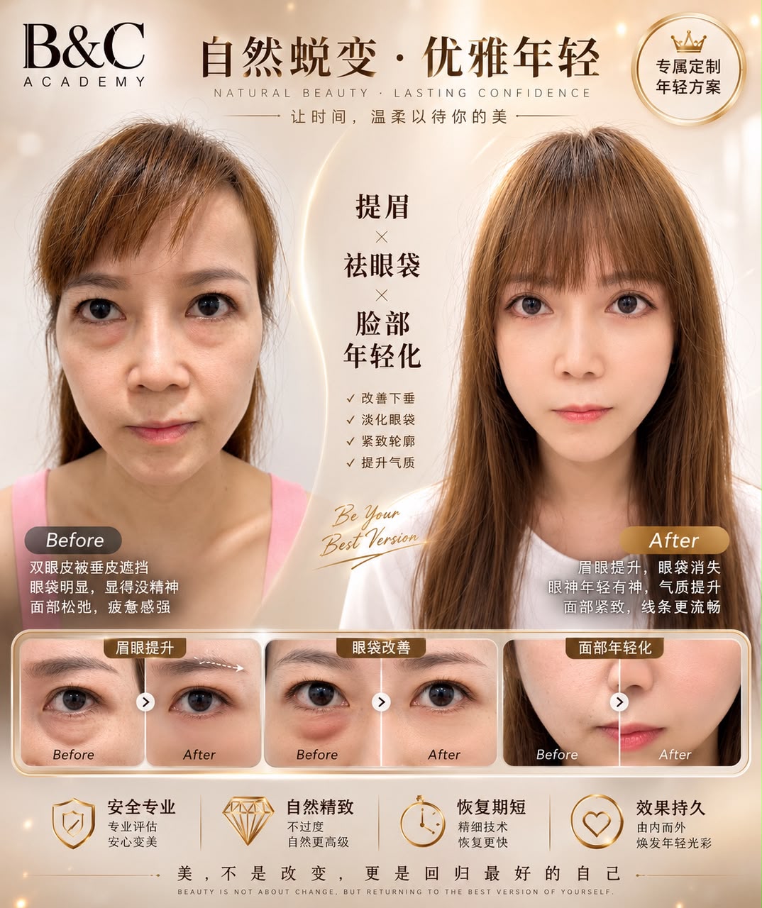 Integrated facial and eye rejuvenation